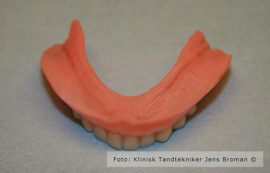 Blød bund i protese Klinisk Tandtekniker Jens Broman
